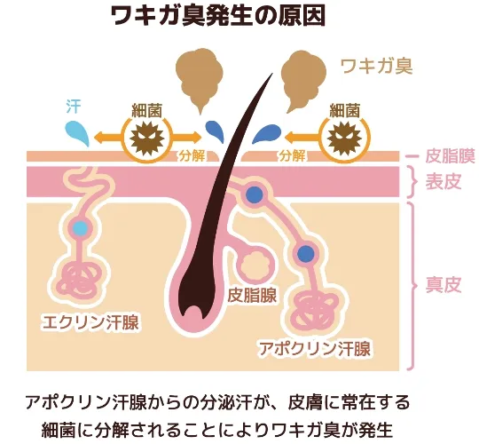 基底細胞がんの種類