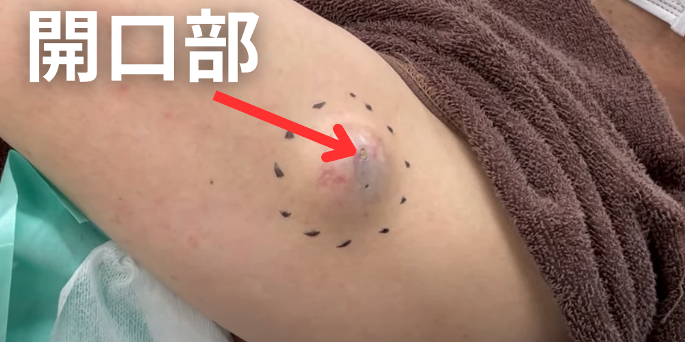 すしこり様専用