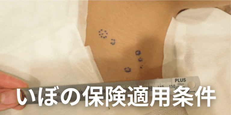皮膚の“ぶよぶよしたできもの”は粉瘤や脂肪腫かも?原因・治療法・受診すべき診療科を解説 - 北海道皮膚のできものと粉瘤クリニック古林形成外科 ...