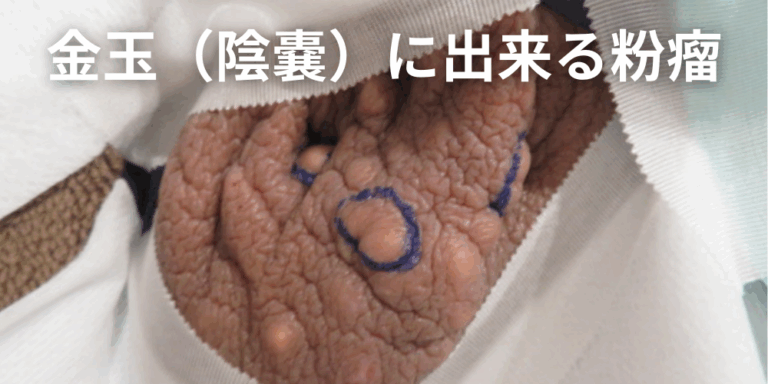 金玉（陰嚢）にできる粉瘤とは？原因・症状・治療法まで解説 - 北海道皮膚のできものと粉瘤クリニック古林形成外科 札幌院｜中央区大通にて皮膚悩み ...